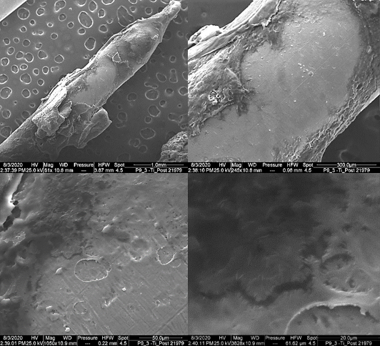 User Foto zeigt eine Bildserie in 61-facher, 245-facher, 1050-facher und 4375-facher Vergrößerung der Proben „Titan Blank“ mit Mikroorganismen Staphyloccocus aureus; post-implantation